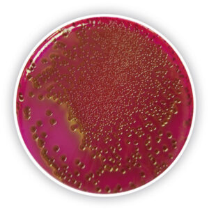 Endo Agar